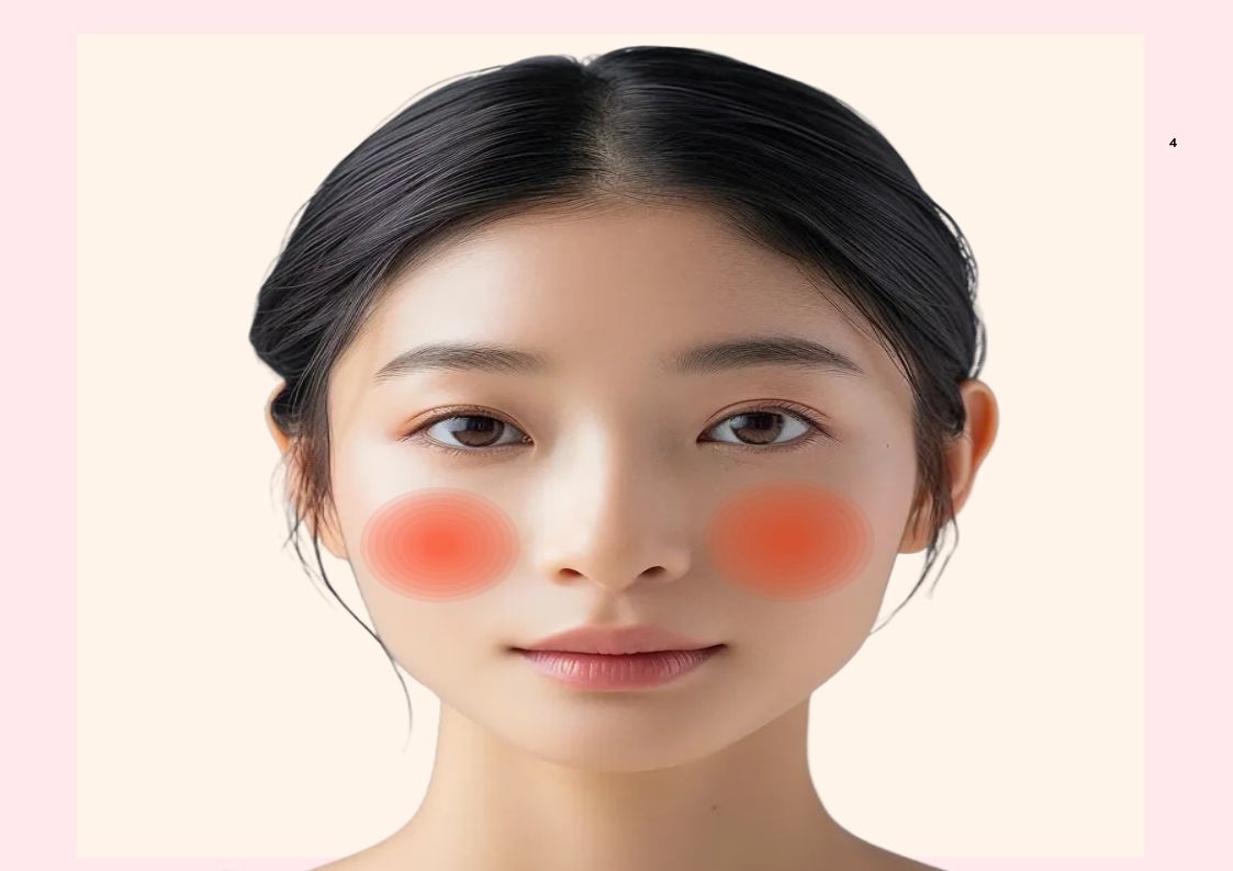 안면홍조